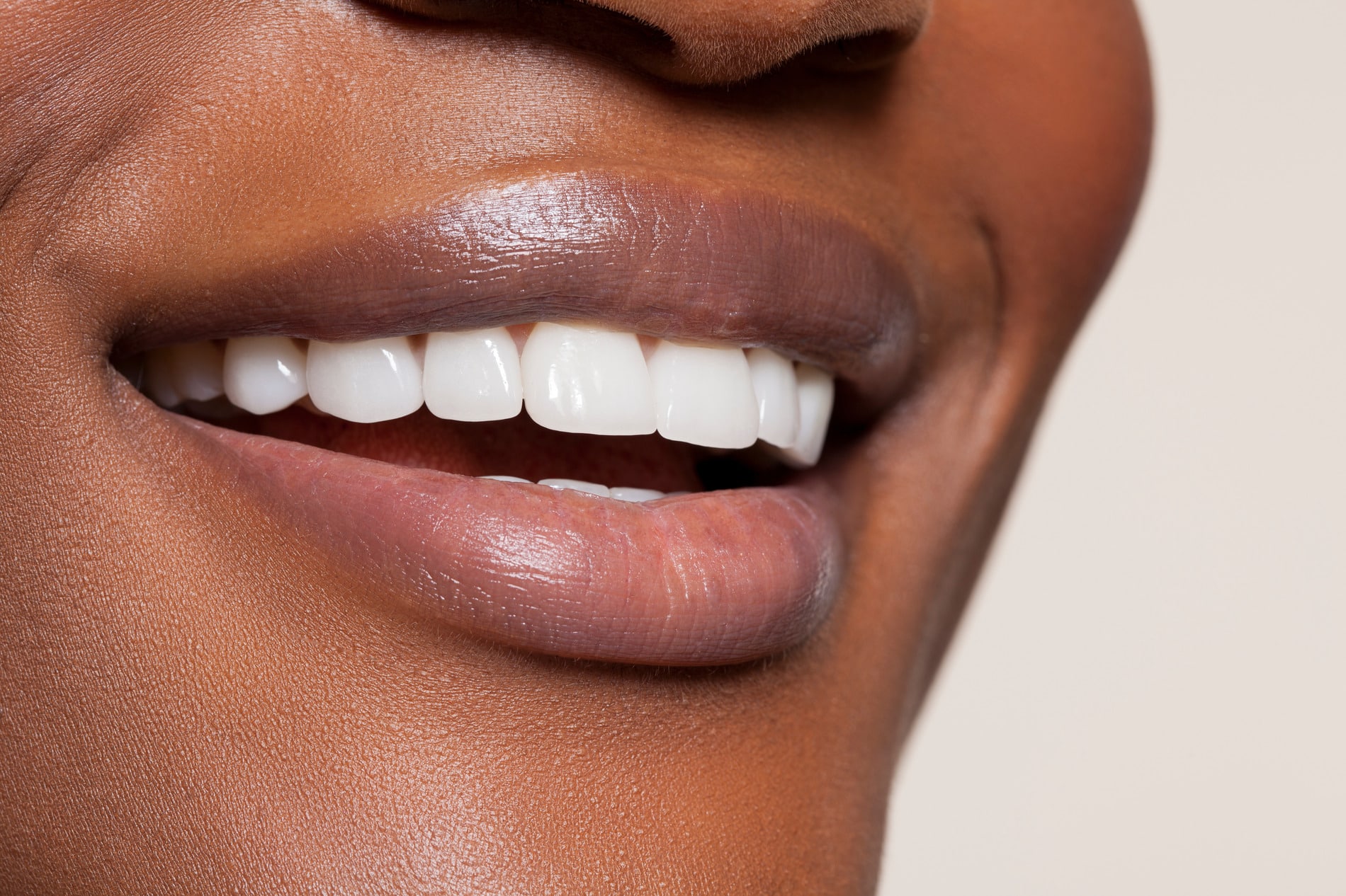 Woman smiling after dental care in Fort Wayne IN